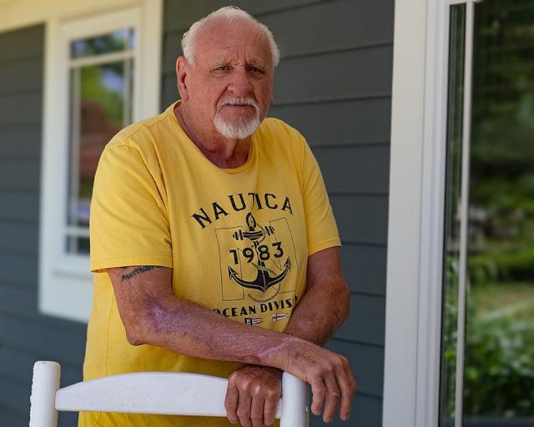 Vernon Spear of Cambridge still bears scars on his forearm from a Vibrio vulnificus infection that put him in the hospital after scratching his arm on a crab pot.