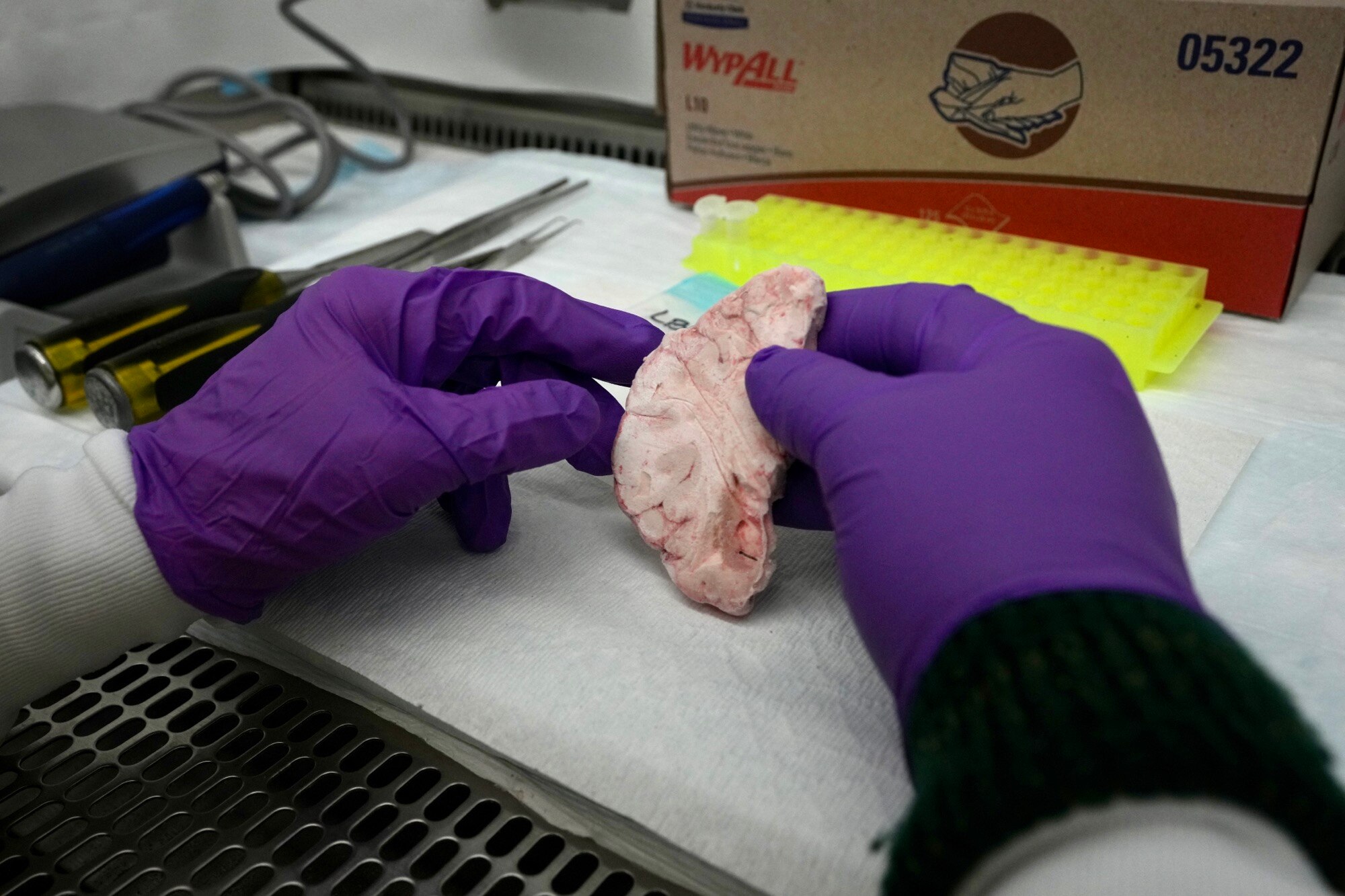 Dr. Tom Hyde, chief medical officer, takes a sample from a donated brain. The Lieber Institute for Brain Development has been working to increase diversity in research, researchers and research subjects and recently got a grant to expand efforts.