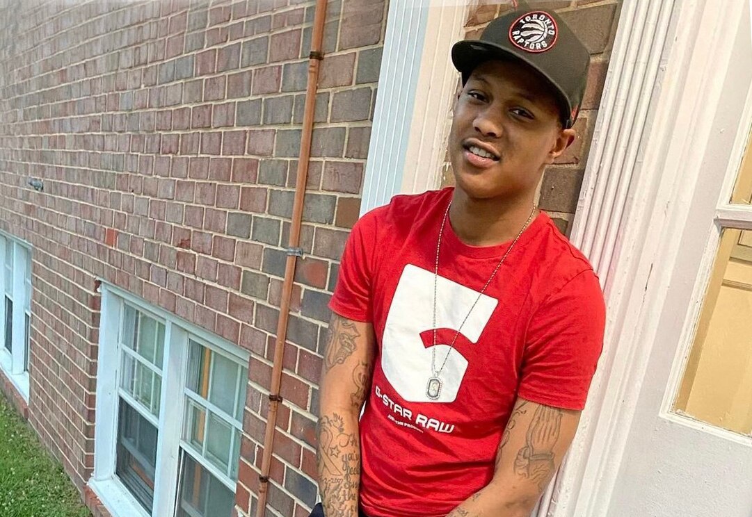 Jonte Gilmore, 26, is being treated for burns at Johns Hopkins Bayview Medical Center.