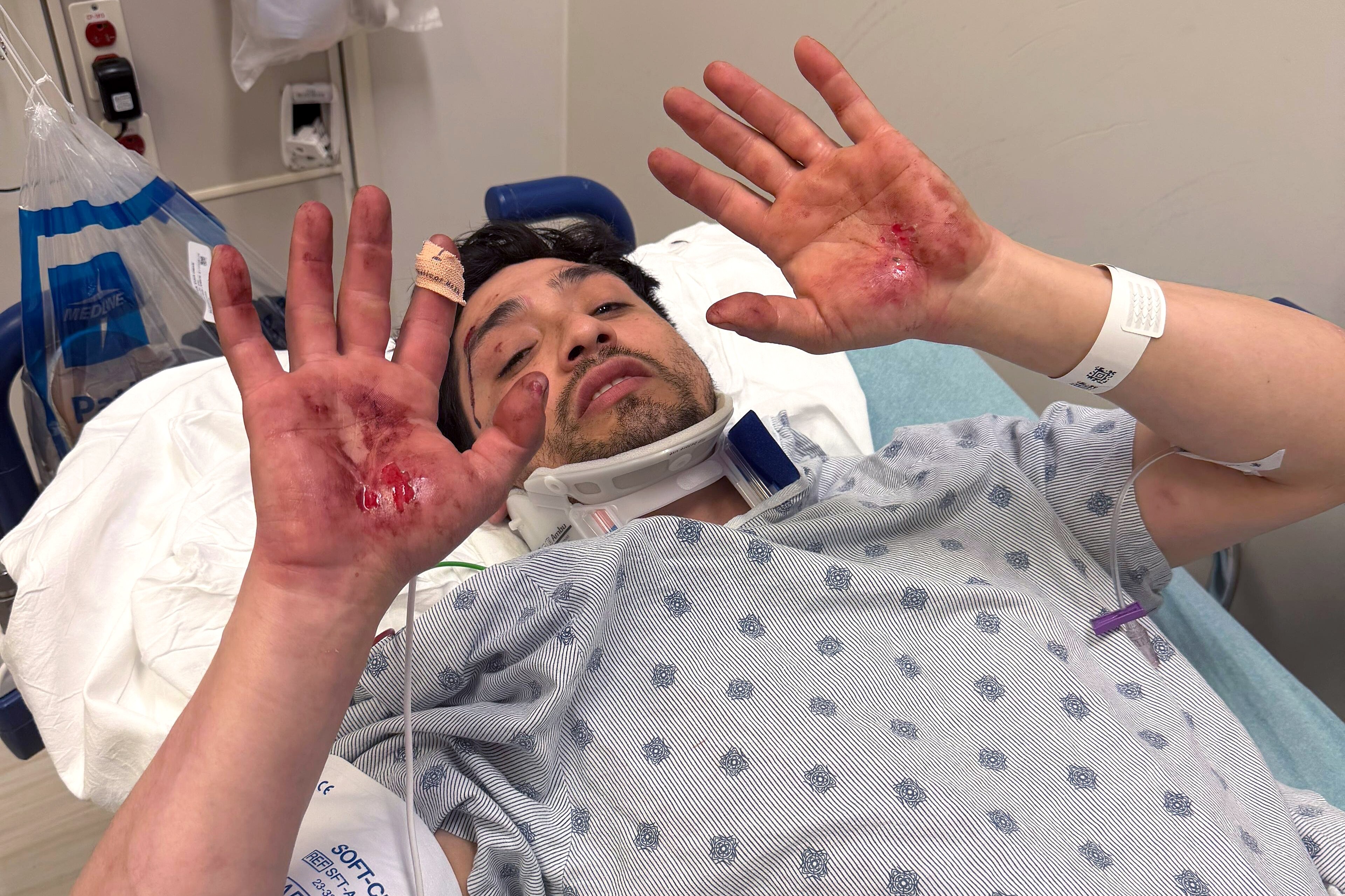 An ICE vehicle rammed into the back of the van Ever Alvarenga Rios was driving on his way to work Thursday morning, his lawyer claims. Alvarenga Rios shows injuries he sustained from the accident.