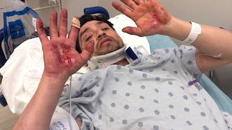 An ICE vehicle rammed into the back of the van Ever Alvarenga Rios was driving on his way to work Thursday morning, his lawyer claims. Alvarenga Rios shows injuries he sustained from the accident.