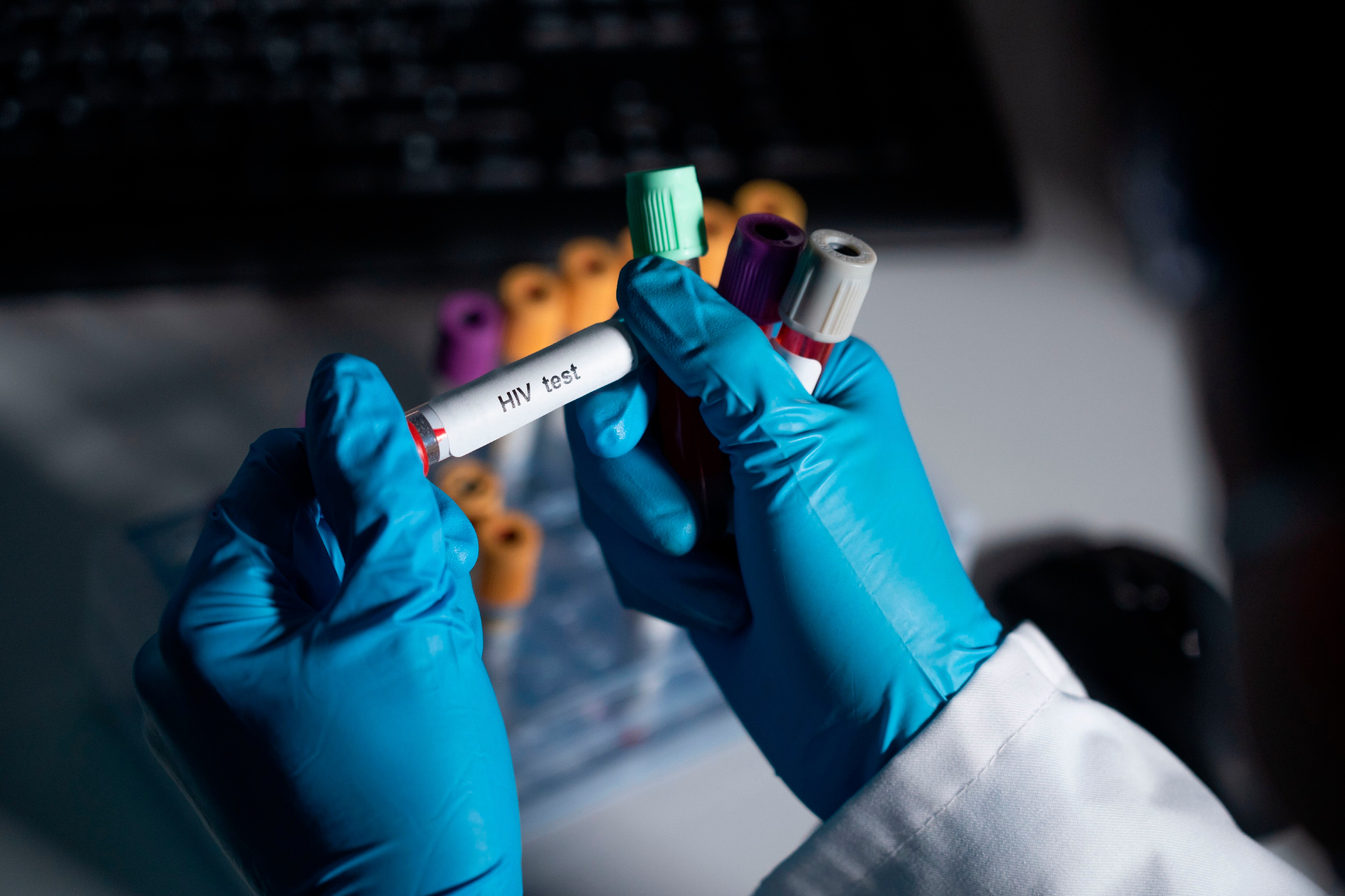 Care for Marylanders with HIV, including outreach and testing, is slated for deep budget cuts.