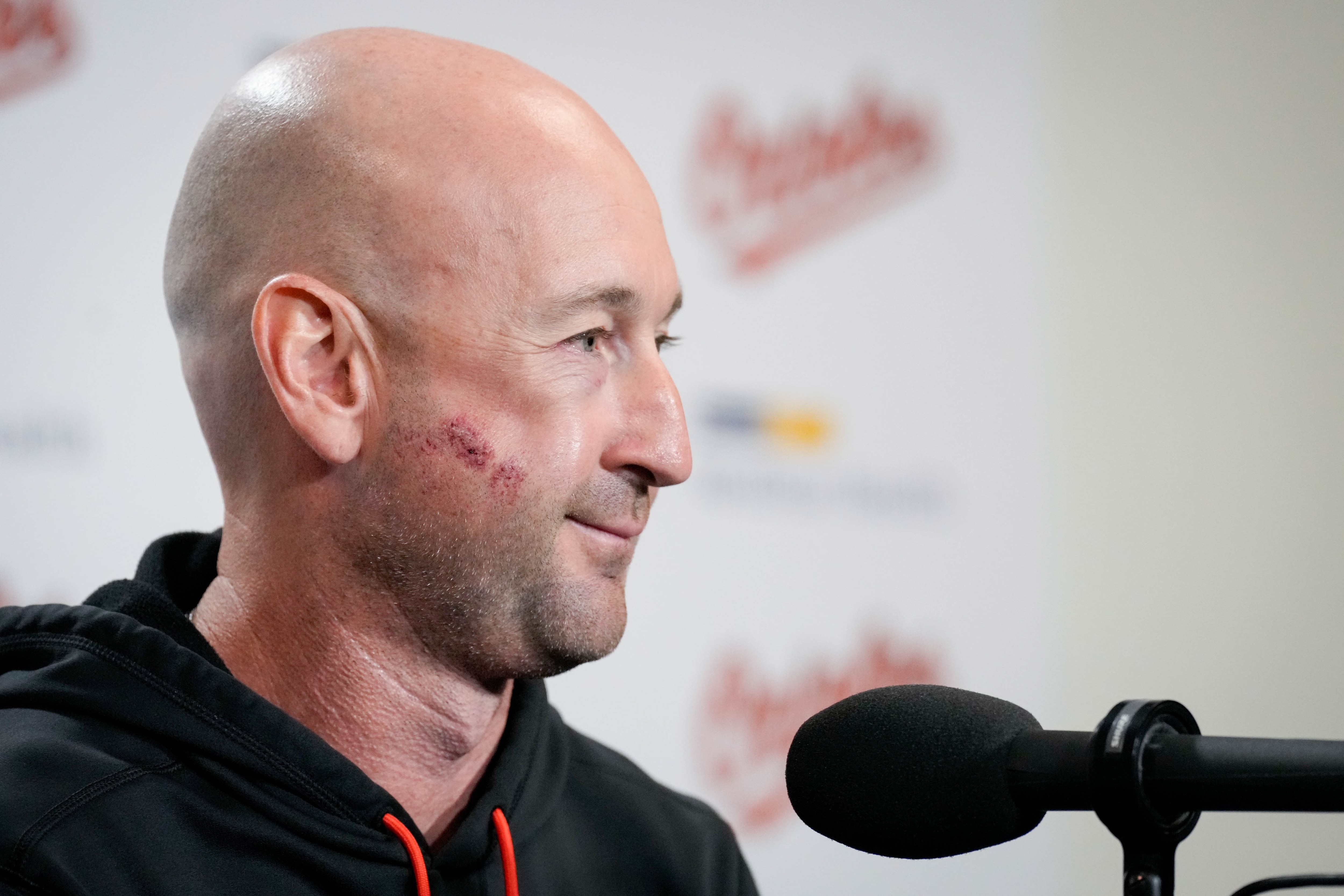 Orioles manager Craig Albernaz takes questions from reporters in the interview room the day after a foul ball struck him in the face.