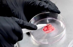 Research assistant Virangika Wimalasena dissects a cancer tumor for a human breast to grow the cultured cell or research.  Dr. Andrew Ewald and fellow scientists at Johns Hopkins received a $35 million grant from researcher, philanthropist and race car driver Theodore Giovanis. Hopkins Medicine will study the biological roots of the most fatal aspect of cancer: how it metastasizes, or spreads, through the body.