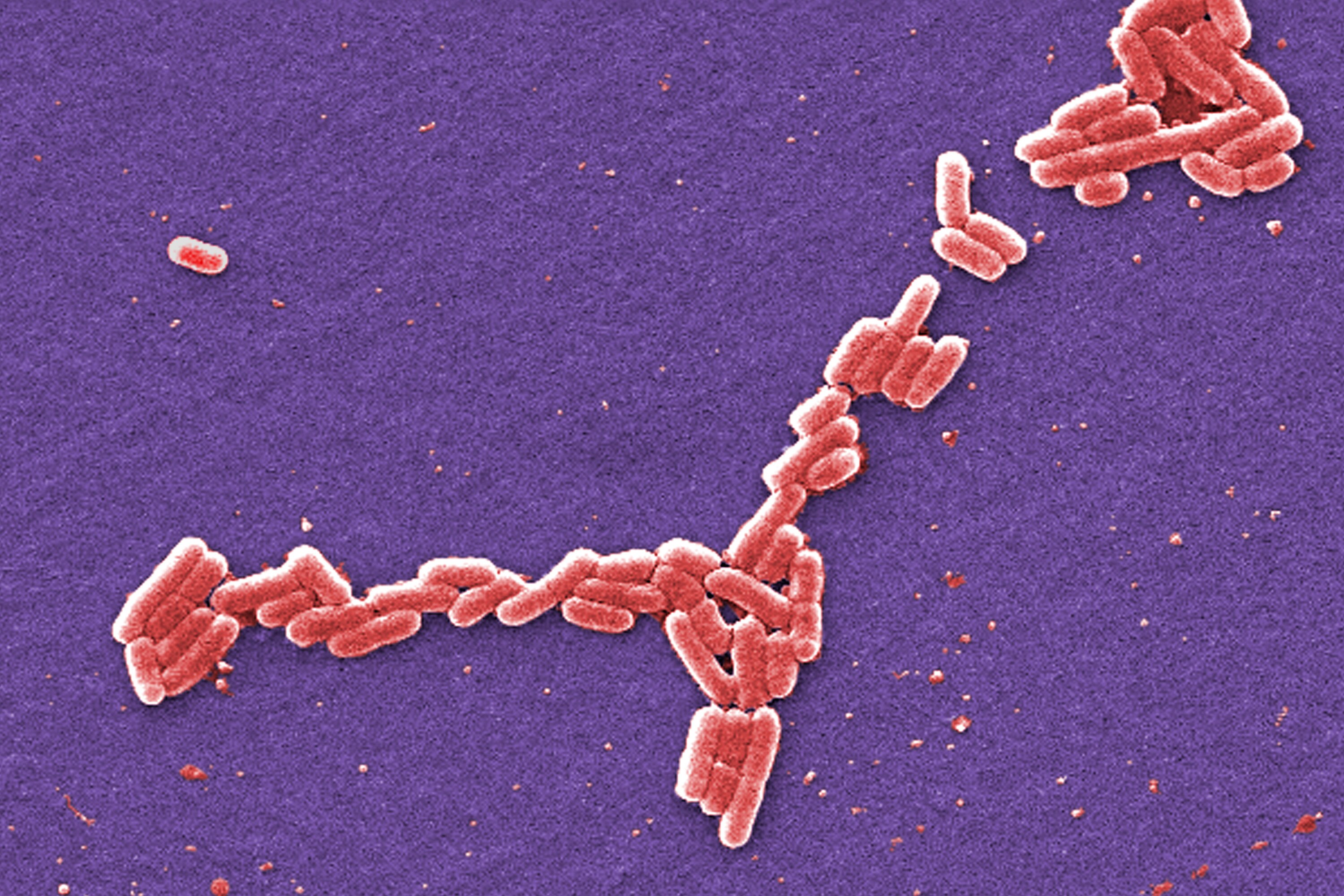 A colorized scan of a microscopic image of E. coli bacteria. The bacteria are tiny red ovals on a purple background